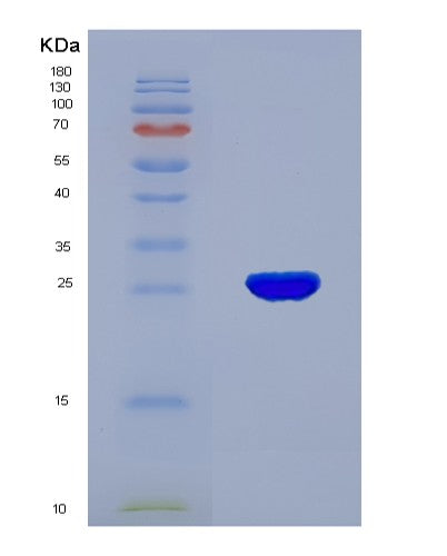 SDS-PAGE analysis of Human TPSAB1 (Tryptase Alpha/Beta-1) - Recombinant Protein, CATHuman TPSAB1 (Tryptase Alpha/Beta-1) - Recombinant Protein