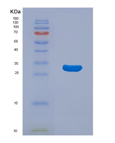 SDS-PAGE analysis of Human MAPRE1 (Microtubule-Associated Protein Rp/Eb Family Member 1) - Recombinant Protein, CAT# BLT-01797P, showing >95% purity under 15% SDS-PAGE (Reduced)Human MAPRE1 (Microtubule-Associated Protein Rp/Eb Family Member 1) - Recombinant Protein