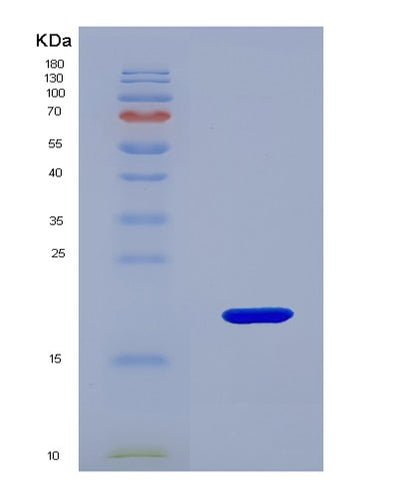 SDS-PAGE analysis of Human KISS1 (Metastasis-Suppressor Kiss-1) - Recombinant Protein, CAT# BLT-01630P, showing >85% purity under 15% SDS-PAGE (Reduced)Human KISS1 (Metastasis-Suppressor Kiss-1) - Recombinant Protein