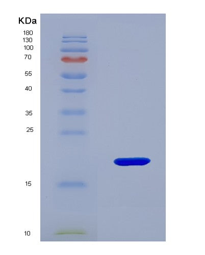 SDS-PAGE analysis of Human KISS1 (Metastasis-Suppressor Kiss-1) - Recombinant Protein, CATHuman KISS1 (Metastasis-Suppressor Kiss-1) - Recombinant Protein