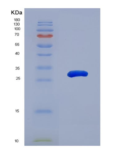 SDS-PAGE analysis of Human MAPK11 (Mitogen-Activated Protein Kinase 11) - Recombinant Protein, CAT# BLT-01789P, showing >95% purity under 15% SDS-PAGE (Reduced)Human MAPK11 (Mitogen-Activated Protein Kinase 11) - Recombinant Protein