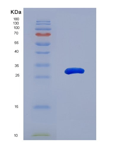 SDS-PAGE analysis of Human MAPK11 (Mitogen-Activated Protein Kinase 11) - Recombinant Protein, CATHuman MAPK11 (Mitogen-Activated Protein Kinase 11) - Recombinant Protein