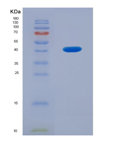 SDS-PAGE analysis of Human CHRNA6 (Neuronal Acetylcholine Receptor Subunit Alpha-6) - Recombinant Protein, CAT# BLT-00600P, showing >95% purity under 15% SDS-PAGE (Reduced)Human CHRNA6 (Neuronal Acetylcholine Receptor Subunit Alpha-6) - Recombinant Protein