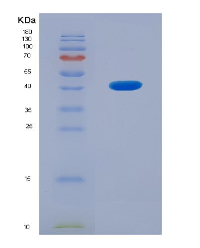 SDS-PAGE analysis of Human CHRNA6 (Neuronal Acetylcholine Receptor Subunit Alpha-6) - Recombinant Protein, CATHuman CHRNA6 (Neuronal Acetylcholine Receptor Subunit Alpha-6) - Recombinant Protein