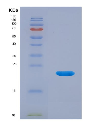 SDS-PAGE analysis of Human ADIPOQ (Adiponectin) - Recombinant Protein, CAT# BLT-00066P, showing >90% purity under 15% SDS-PAGE (Reduced)Human ADIPOQ (Adiponectin) - Recombinant Protein