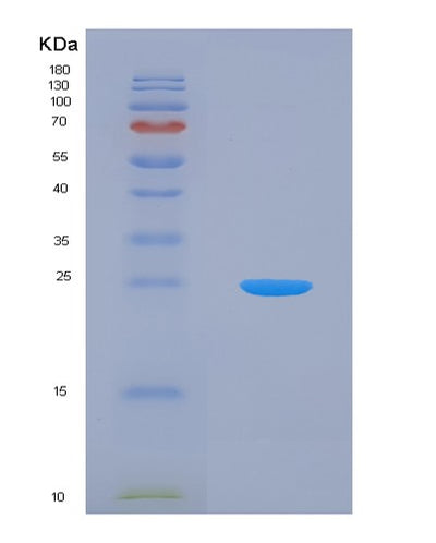 SDS-PAGE analysis of Human HSPB2 (Heat Shock Protein Beta-2) - Recombinant Protein, CAT# BLT-01448P, showing >95% purity under 15% SDS-PAGE (Reduced)Human HSPB2 (Heat Shock Protein Beta-2) - Recombinant Protein