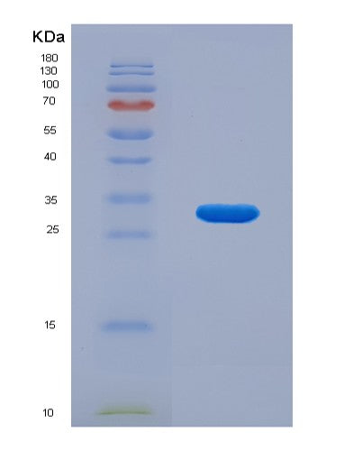 SDS-PAGE analysis of Human MAPK14 (Mitogen-Activated Protein Kinase 14) - Recombinant Protein, CATHuman MAPK14 (Mitogen-Activated Protein Kinase 14) - Recombinant Protein