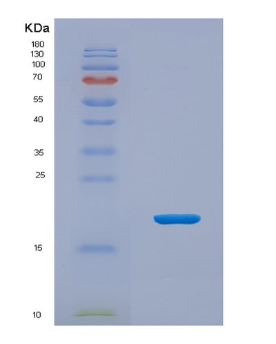 SDS-PAGE analysis of Human MOG (Myelin-Oligodendrocyte Glycoprotein) - Recombinant Protein, CAT# BLT-05605P, showing >95% purity under 15% SDS-PAGE (Reduced)Human MOG (Myelin-Oligodendrocyte Glycoprotein) - Recombinant Protein