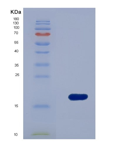 SDS-PAGE analysis of Human FSCN1 (Fascin) - Recombinant Protein, CATHuman FSCN1 (Fascin) - Recombinant Protein