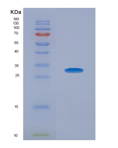 SDS-PAGE analysis of Human RORC (Nuclear Receptor Ror-Gamma) - Recombinant Protein, CAT# BLT-07723P, showing >90% purity under 15% SDS-PAGE (Reduced)Human RORC (Nuclear Receptor Ror-Gamma) - Recombinant Protein