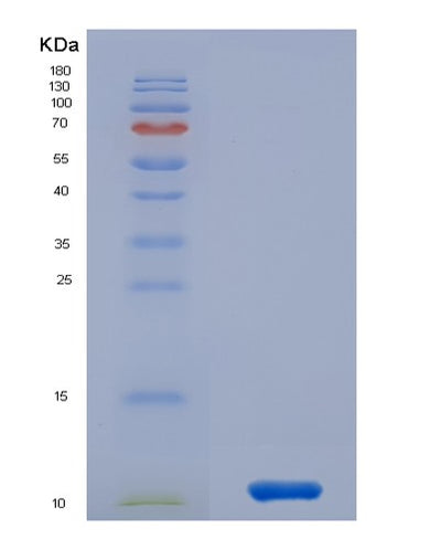 SDS-PAGE analysis of Human CCL15 (C-C Motif Chemokine 15) - Recombinant Protein, CAT# BLT-00437P, showing >90% purity under 15% SDS-PAGE (Reduced)Human CCL15 (C-C Motif Chemokine 15) - Recombinant Protein