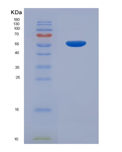 SDS-PAGE analysis of Human CDKN3 (Cyclin-Dependent Kinase Inhibitor 3) - Recombinant Protein, CAT# BLT-00551P, showing >90% purity under 15% SDS-PAGE (Reduced)Human CDKN3 (Cyclin-Dependent Kinase Inhibitor 3) - Recombinant Protein