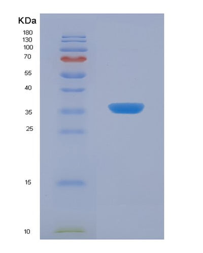 SDS-PAGE analysis of Human TST (Thiosulfate Sulfurtransferase) - Recombinant Protein, CAT# BLT-03032P, showing >95% purity under 15% SDS-PAGE (Reduced)Human TST (Thiosulfate Sulfurtransferase) - Recombinant Protein