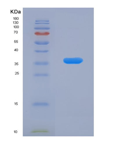 SDS-PAGE analysis of Human DUSP6 (Dual Specificity Protein Phosphatase 6) - Recombinant Protein, CAT# BLT-00907P, showing >90% purity under 15% SDS-PAGE (Reduced)Human DUSP6 (Dual Specificity Protein Phosphatase 6) - Recombinant Protein