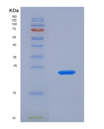 SDS-PAGE analysis of Human PTPRN (Receptor-Type Tyrosine-Protein Phosphatase-Like N) - Recombinant Protein, CATHuman PTPRN (Receptor-Type Tyrosine-Protein Phosphatase-Like N) - Recombinant Protein