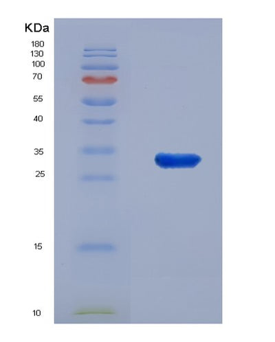 SDS-PAGE analysis of Human MOK (Mapk/Mak/Mrk Overlapping Kinase) - Recombinant Protein, CAT# BLT-07724P, showing >90% purity under 15% SDS-PAGE (Reduced)Human MOK (Mapk/Mak/Mrk Overlapping Kinase) - Recombinant Protein