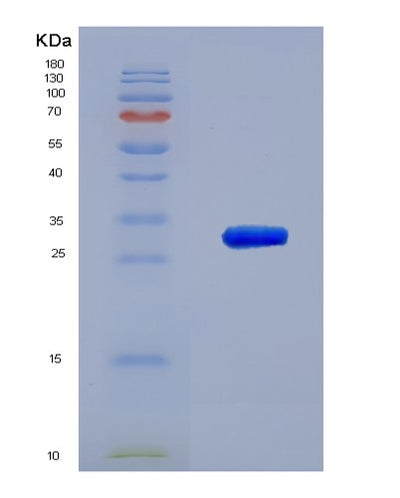 SDS-PAGE analysis of Human TXNRD1 (Thioredoxin Reductase 1, Cytoplasmic) - Recombinant Protein, CAT# BLT-03178P, showing >90% purity under 15% SDS-PAGE (Reduced)Human TXNRD1 (Thioredoxin Reductase 1, Cytoplasmic) - Recombinant Protein
