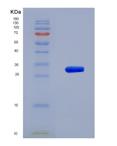 SDS-PAGE analysis of Human TXNRD1 (Thioredoxin Reductase 1, Cytoplasmic) - Recombinant Protein, CATHuman TXNRD1 (Thioredoxin Reductase 1, Cytoplasmic) - Recombinant Protein