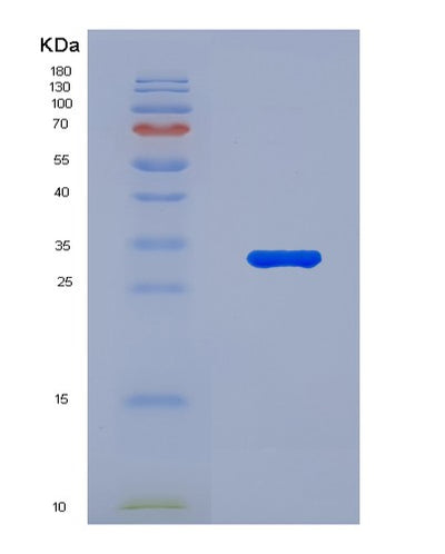 SDS-PAGE analysis of Human YAP1 (Transcriptional Coactivator Yap1) - Recombinant Protein, CAT# BLT-07725P, showing >90% purity under 15% SDS-PAGE (Reduced)Human YAP1 (Transcriptional Coactivator Yap1) - Recombinant Protein