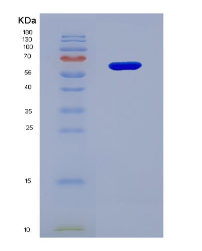 SDS-PAGE analysis of Human MICA (Mhc Class I Polypeptide-Related Sequence A) - Recombinant Protein, CAT# BLT-01851P, showing >95% purity under 15% SDS-PAGE (Reduced)Human MICA (Mhc Class I Polypeptide-Related Sequence A) - Recombinant Protein