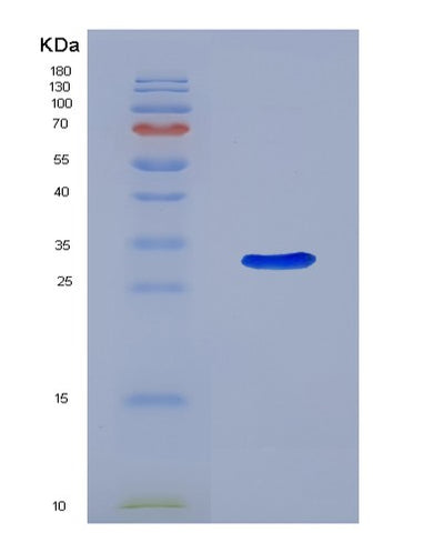 SDS-PAGE analysis of Human ABCB5 (Atp-Binding Cassette Sub-Family B Member 5) - Recombinant Protein, CAT# BLT-04787P, showing >85% purity under 15% SDS-PAGE (Reduced)Human ABCB5 (Atp-Binding Cassette Sub-Family B Member 5) - Recombinant Protein