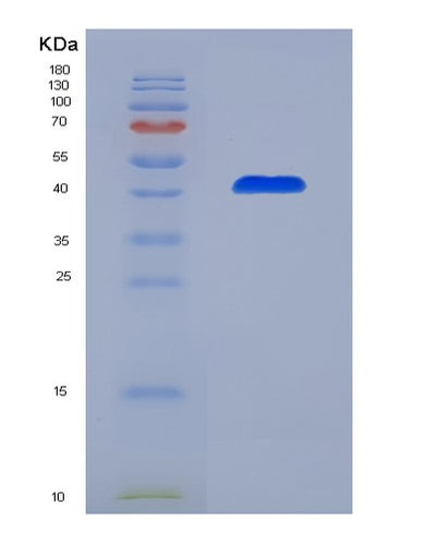 SDS-PAGE analysis of Human BCL7A (B-Cell Cll/Lymphoma 7 Protein Family Member A) - Recombinant Protein, CAT# BLT-00305P, showing >85% purity under 15% SDS-PAGE (Reduced)Human BCL7A (B-Cell Cll/Lymphoma 7 Protein Family Member A) - Recombinant Protein