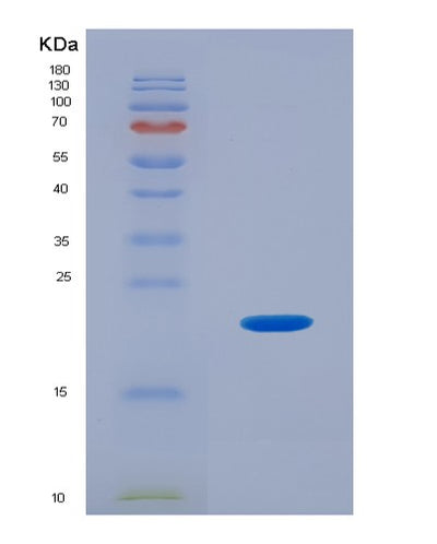 SDS-PAGE analysis of Human PHLDA2 (Pleckstrin Homology-Like Domain Family A Member 2) - Recombinant Protein, CAT# BLT-02254P, showing >85% purity under 15% SDS-PAGE (Reduced)Human PHLDA2 (Pleckstrin Homology-Like Domain Family A Member 2) - Recombinant Protein