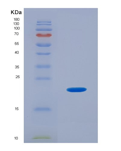 SDS-PAGE analysis of Human PHLDA2 (Pleckstrin Homology-Like Domain Family A Member 2) - Recombinant Protein, CATHuman PHLDA2 (Pleckstrin Homology-Like Domain Family A Member 2) - Recombinant Protein