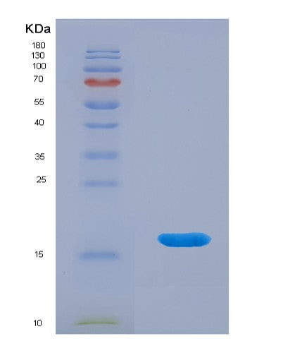 SDS-PAGE analysis of Human PLA1A (Phospholipase A1 Member A) - Recombinant Protein, CATHuman PLA1A (Phospholipase A1 Member A) - Recombinant Protein