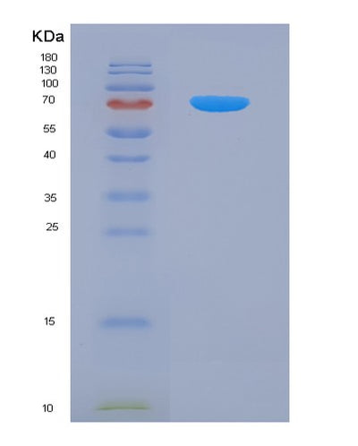 SDS-PAGE analysis of Mouse Pparg (Peroxisome Proliferator-Activated Receptor Gamma) - Recombinant Protein, CAT# BLT-07726P, showing >90% purity under 15% SDS-PAGE (Reduced)Mouse Pparg (Peroxisome Proliferator-Activated Receptor Gamma) - Recombinant Protein