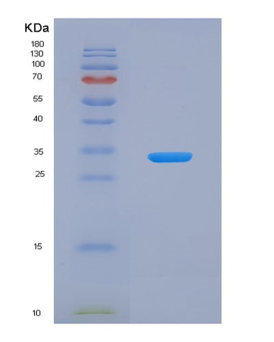 SDS-PAGE analysis of Human SMUG1 (Single-Strand Selective Monofunctional Uracil Dna Glycosylase) - Recombinant Protein, CAT# BLT-02812P, showing >95% purity under 15% SDS-PAGE (Reduced)Human SMUG1 (Single-Strand Selective Monofunctional Uracil Dna Glycosylase) - Recombinant Protein