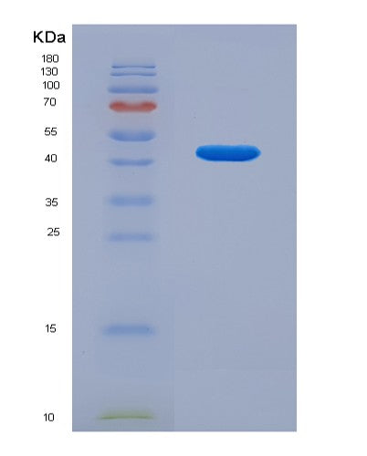 SDS-PAGE analysis of Human OCIAD2 (Ocia Domain-Containing Protein 2) - Recombinant Protein, CATHuman OCIAD2 (Ocia Domain-Containing Protein 2) - Recombinant Protein
