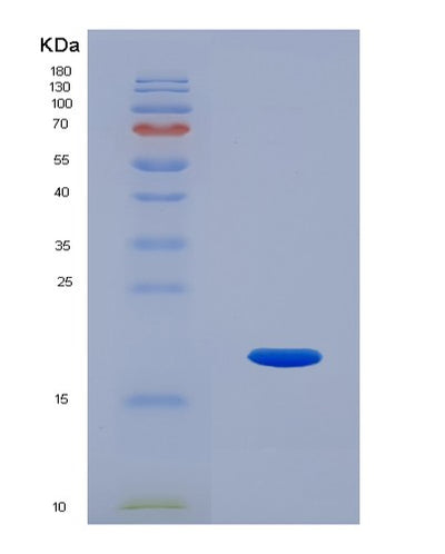 SDS-PAGE analysis of Human RNLS (Renalase) - Recombinant Protein, CAT# BLT-02603P, showing >85% purity under 15% SDS-PAGE (Reduced)Human RNLS (Renalase) - Recombinant Protein