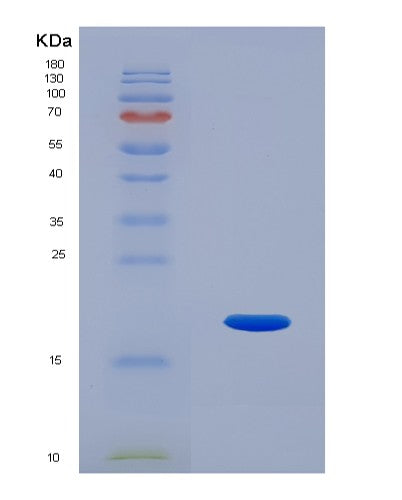 SDS-PAGE analysis of Human RNLS (Renalase) - Recombinant Protein, CATHuman RNLS (Renalase) - Recombinant Protein
