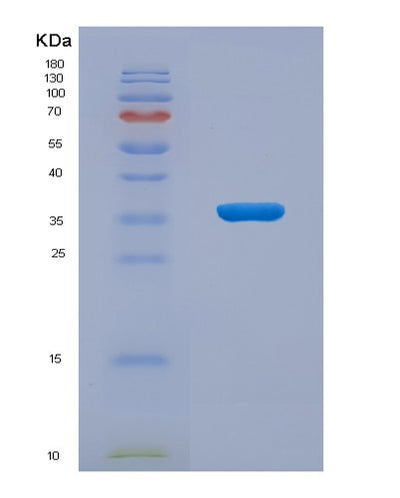 SDS-PAGE analysis of Human STEAP2 (Metalloreductase Steap2) - Recombinant Protein, CAT# BLT-07727P, showing >90% purity under 15% SDS-PAGE (Reduced)Human STEAP2 (Metalloreductase Steap2) - Recombinant Protein