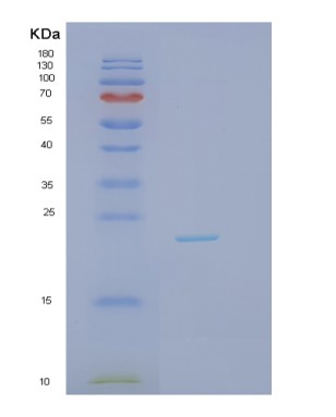 SDS-PAGE analysis of Human IL1A (Interleukin-1 Alpha) - Recombinant Protein, CAT# BLT-07728P, showing >90% purity under 15% SDS-PAGE (Reduced)Human IL1A (Interleukin-1 Alpha) - Recombinant Protein