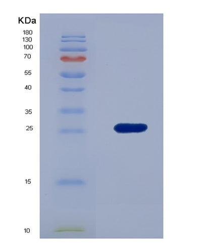 SDS-PAGE analysis of Human LAMA2 (Laminin Subunit Alpha-2) - Recombinant Protein, CAT# BLT-07729P, showing >90% purity under 15% SDS-PAGE (Reduced)Human LAMA2 (Laminin Subunit Alpha-2) - Recombinant Protein