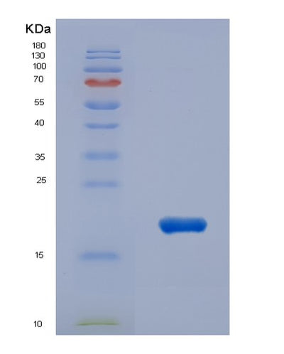 SDS-PAGE analysis of Human IL31 (Interleukin-31) - Recombinant Protein, CAT# BLT-04687P, showing >90% purity under 15% SDS-PAGE (Reduced)Human IL31 (Interleukin-31) - Recombinant Protein
