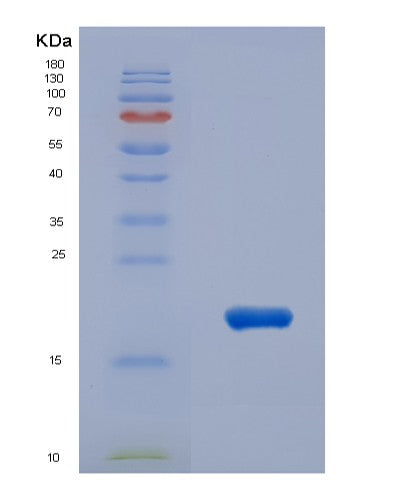 SDS-PAGE analysis of Human IL31 (Interleukin-31) - Recombinant Protein, CATHuman IL31 (Interleukin-31) - Recombinant Protein