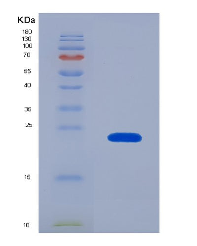 SDS-PAGE analysis of Human LAIR1 (Leukocyte-Associated Immunoglobulin-Like Receptor 1) - Recombinant Protein, CAT# BLT-01670P, showing >90% purity under 15% SDS-PAGE (Reduced)Human LAIR1 (Leukocyte-Associated Immunoglobulin-Like Receptor 1) - Recombinant Protein
