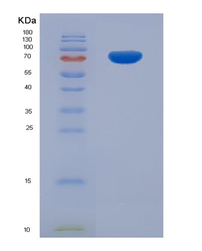 SDS-PAGE analysis of Human ETFDH (Electron Transfer Flavoprotein-Ubiquinone Oxidoreductase, Mitochondrial) - Recombinant Protein, CAT# BLT-07700P, showing >90% purity under 15% SDS-PAGE (Reduced)Human ETFDH (Electron Transfer Flavoprotein-Ubiquinone Oxidoreductase, Mitochondrial) - Recombinant Protein