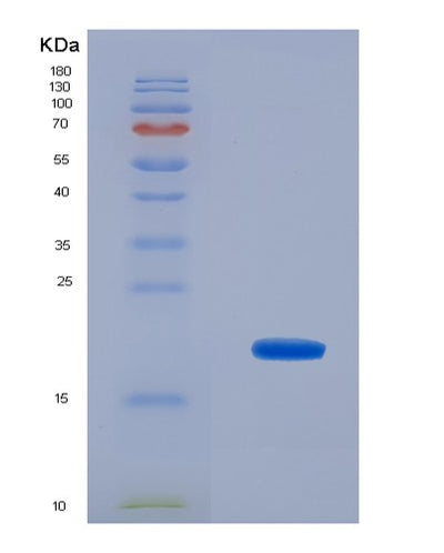 SDS-PAGE analysis of Human TNNT3 (Troponin T, Fast Skeletal Muscle) - Recombinant Protein, CAT# BLT-07731P, showing >90% purity under 15% SDS-PAGE (Reduced)Human TNNT3 (Troponin T, Fast Skeletal Muscle) - Recombinant Protein