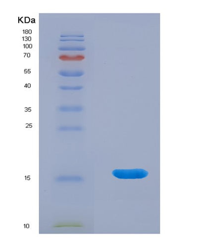 SDS-PAGE analysis of Human LAIR2 (Leukocyte-Associated Immunoglobulin-Like Receptor 2) - Recombinant Protein, CAT# BLT-01672P, showing >95% purity under 15% SDS-PAGE (Reduced)Human LAIR2 (Leukocyte-Associated Immunoglobulin-Like Receptor 2) - Recombinant Protein