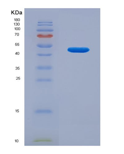 SDS-PAGE analysis of Human AAGAB (Alpha- And Gamma-Adaptin-Binding Protein P34) - Recombinant Protein, CAT# BLT-00013P, showing >95% purity under 15% SDS-PAGE (Reduced)Human AAGAB (Alpha- And Gamma-Adaptin-Binding Protein P34) - Recombinant Protein