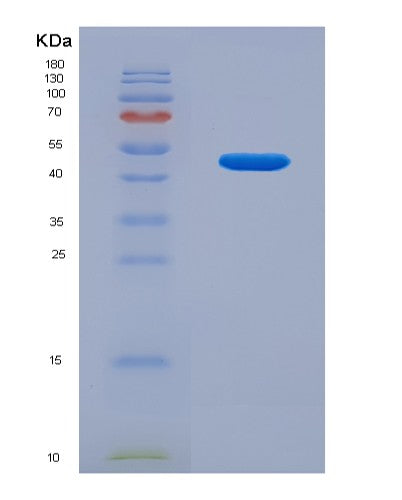SDS-PAGE analysis of Human AAGAB (Alpha- And Gamma-Adaptin-Binding Protein P34) - Recombinant Protein, CATHuman AAGAB (Alpha- And Gamma-Adaptin-Binding Protein P34) - Recombinant Protein
