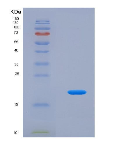 SDS-PAGE analysis of Human CPLX2 (Complexin-2) - Recombinant Protein, CATHuman CPLX2 (Complexin-2) - Recombinant Protein