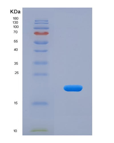 SDS-PAGE analysis of Human APOA5 (Apolipoprotein A-V) - Recombinant Protein, CAT# BLT-00185P, showing >95% purity under 15% SDS-PAGE (Reduced)Human APOA5 (Apolipoprotein A-V) - Recombinant Protein