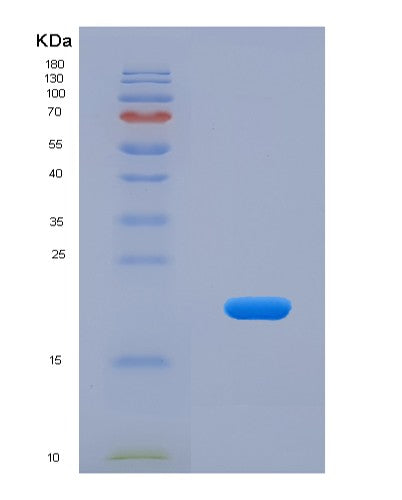 SDS-PAGE analysis of Human APOA5 (Apolipoprotein A-V) - Recombinant Protein, CATHuman APOA5 (Apolipoprotein A-V) - Recombinant Protein