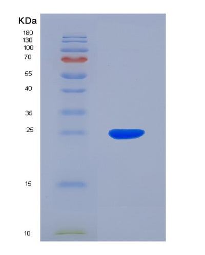 SDS-PAGE analysis of Human ANGPTL8 (Angiopoietin-Like Protein 8) - Recombinant Protein, CAT# BLT-04703P, showing >85% purity under 15% SDS-PAGE (Reduced)Human ANGPTL8 (Angiopoietin-Like Protein 8) - Recombinant Protein