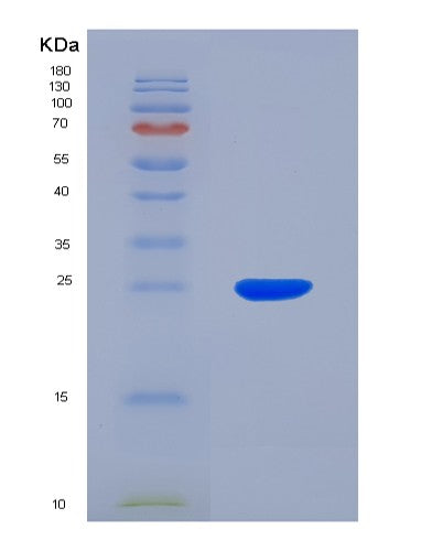 SDS-PAGE analysis of Human ANGPTL8 (Angiopoietin-Like Protein 8) - Recombinant Protein, CATHuman ANGPTL8 (Angiopoietin-Like Protein 8) - Recombinant Protein